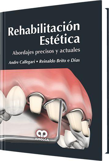 Rehabilitación Estética. Abordajes Precisos Y Actuales Rehabilitación Estética. Abordajes Precisos Y Actuales
